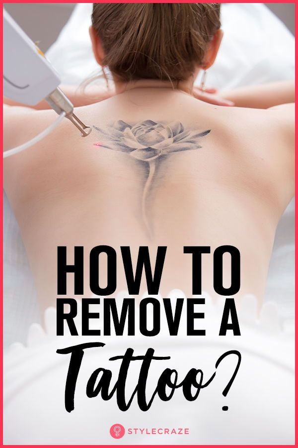 How to remove a tattoo step by step?