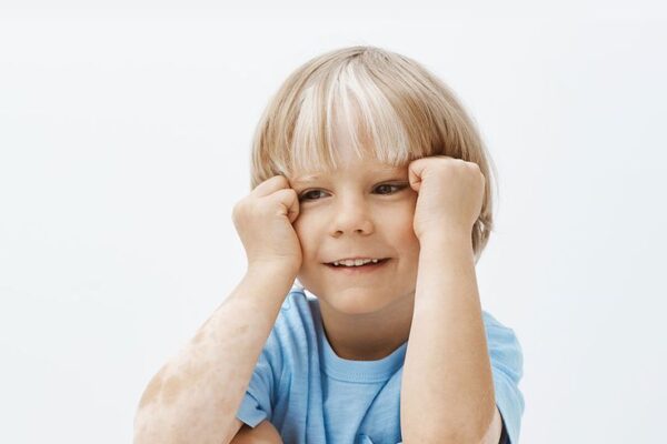 White spots on the skin in children: what could it be?